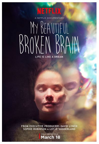 beautiful broken brain